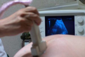 Testovi i pregledi u trudnoći