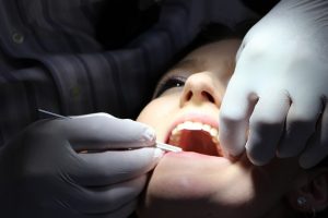 Saveti posle vađenja zuba